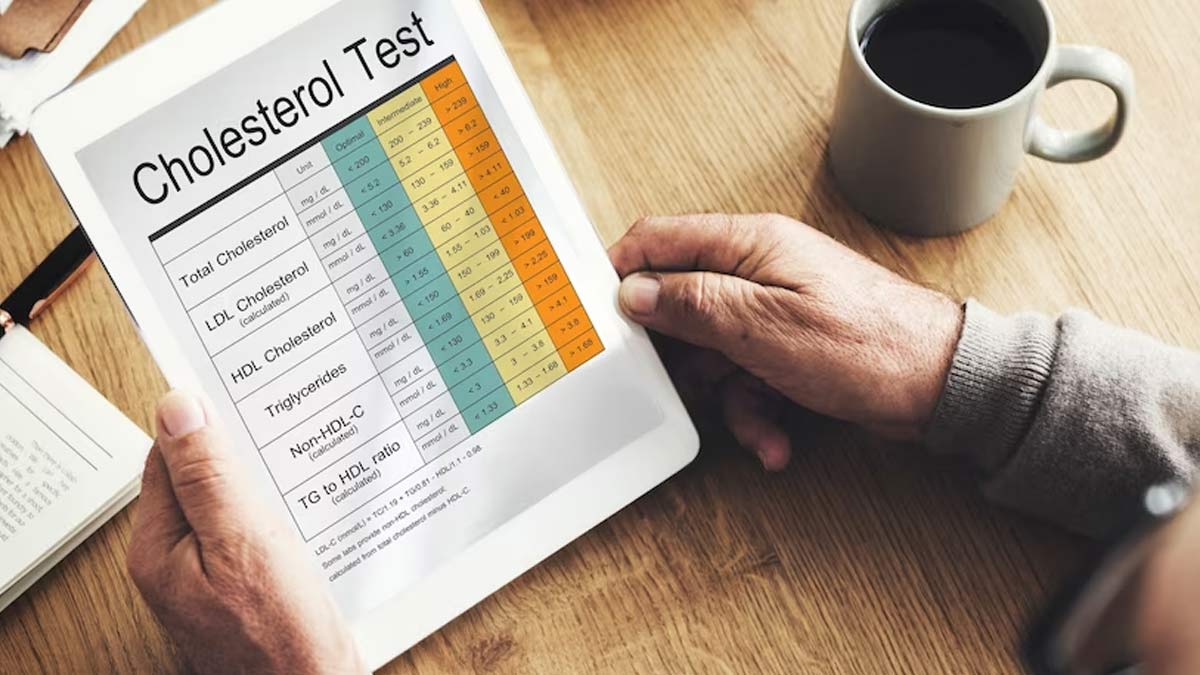 How Often Should You Get A Cholesterol Test 