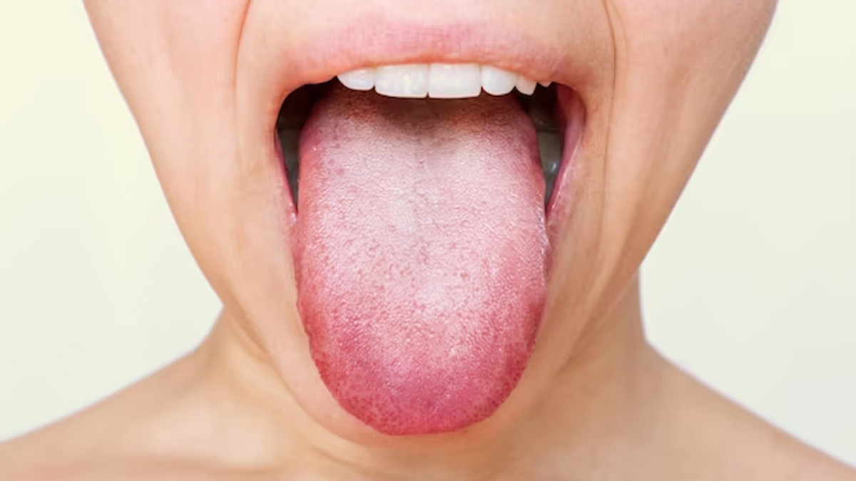 Swollen Taste Buds: Possible Causes That Can Lead To The Condition 